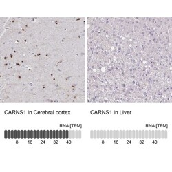 ATPGD1 Antibody, Novus Biologicals:Antibodies:Primary Antibodies